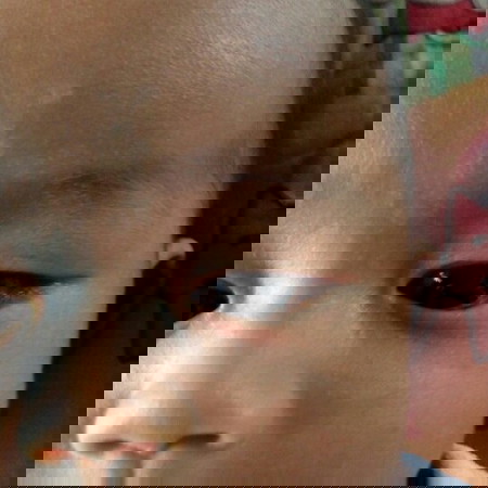 ขี้กลาก