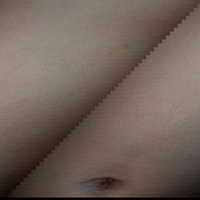 ลักษณะอาการภูมิแพ้ของเด็กทารก