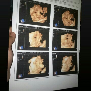 36 week