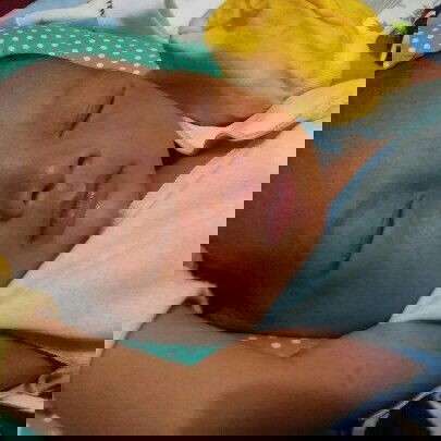 kulit muka kering kepala biang keringat