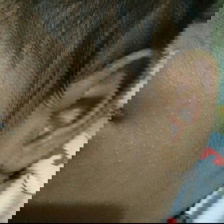bintik2