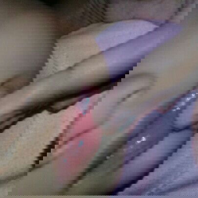 sariawan dan putih putih terdapat di lidah dan rahang atas pada bayi 7 bulan