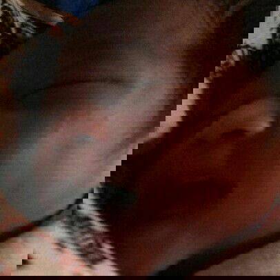 bintik bintik di wajah bayi