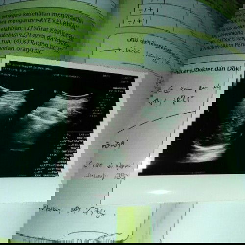 kepala bayi belum masuk panggul