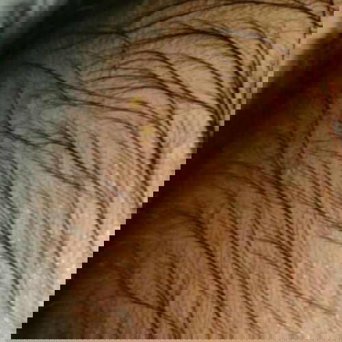 kepala bayi seperti ada nanah