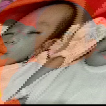 bulu bulu pada kulit  bayi