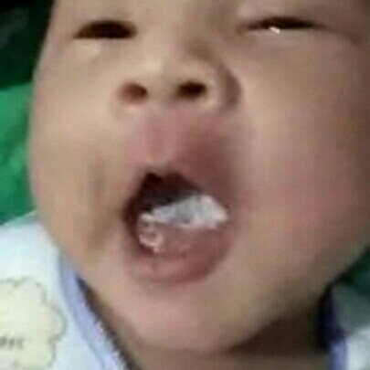 putih pada lidah