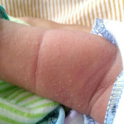 bintik putih