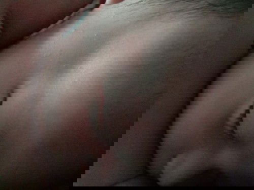 bintik pada kulit anak