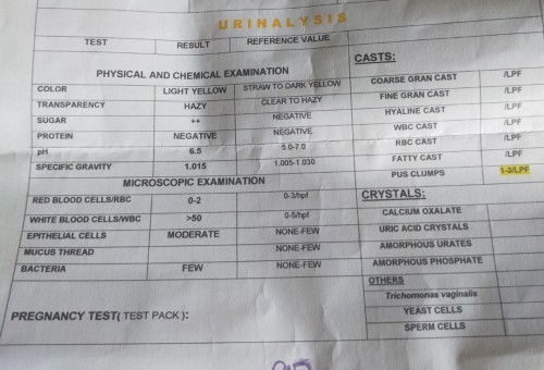 Urinalysis result