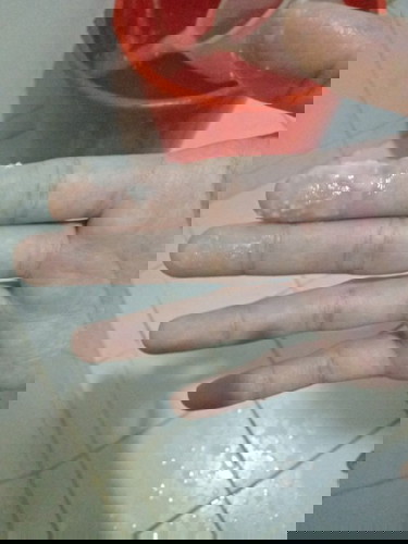 Normal lang poba may lumabas saken white discharge?