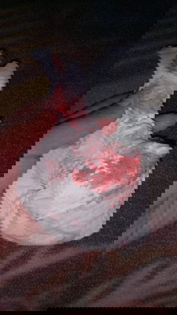 Keluar flek darah dan beberapa kali kontraksi