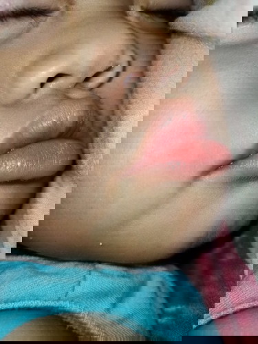 บ้านไหนเคยเป็นบ้าง