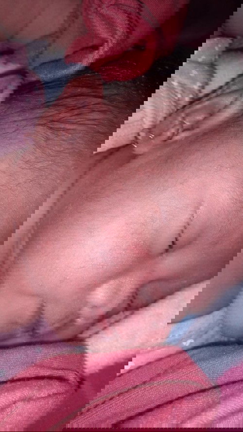 bintik kasar dan merah pada pipi