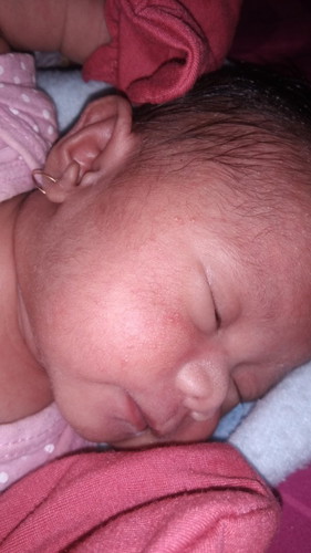 bintik kasar dan merah pada pipi