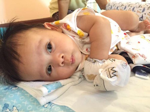 น้องแพ้นมวัว