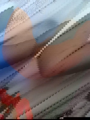 Insect Bites