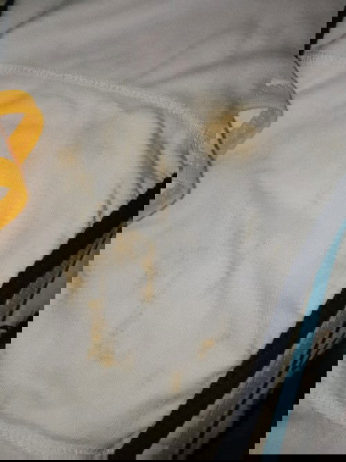 pipis bayi ada bercak