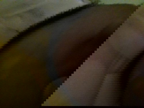 kepala ada putih putih nya