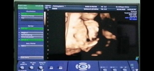 เด็กขี้อาย