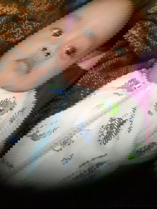 obat biang keringat bayi