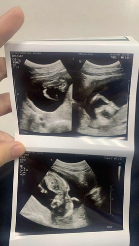 15W+6D เพศชายค่ะ