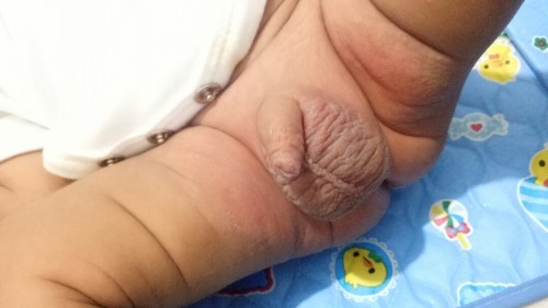 rashes