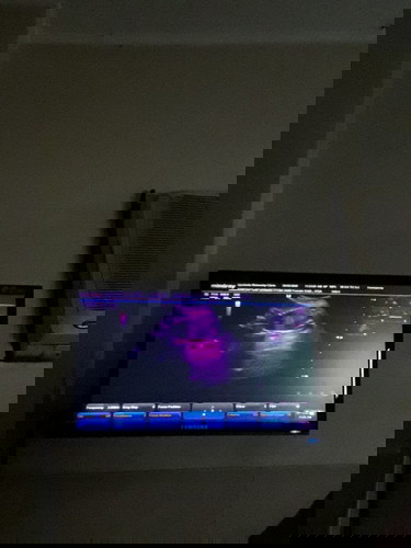 ultrasound