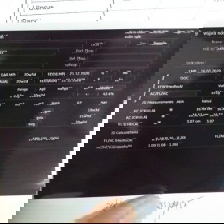 ผลตรวจอัลตร้าซาวด์