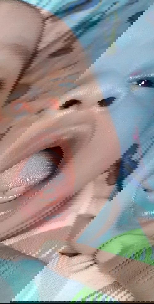 tumbuh gigi sejak lahir