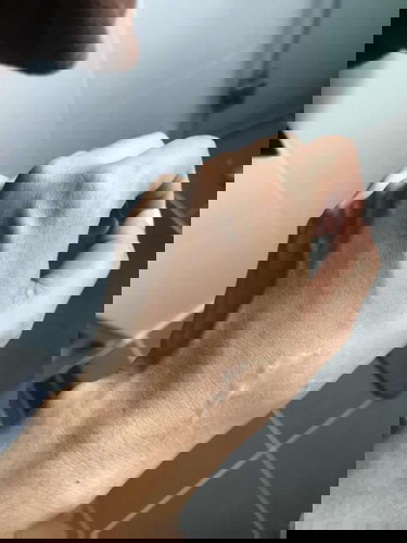 มีมูกขาวใสแบบนี้ 2 วันแล้ว ตอนนี้ 35 week