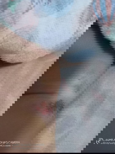 ano pong magandang cream or ointment