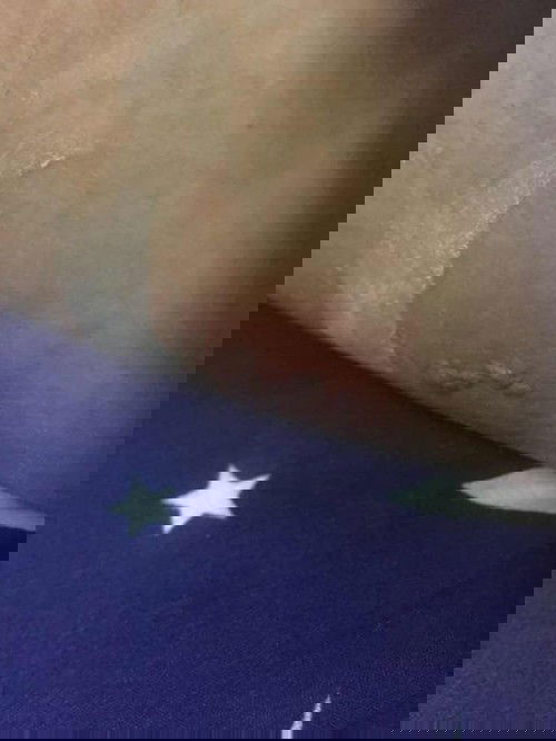 เป็นงูสวัดคะ