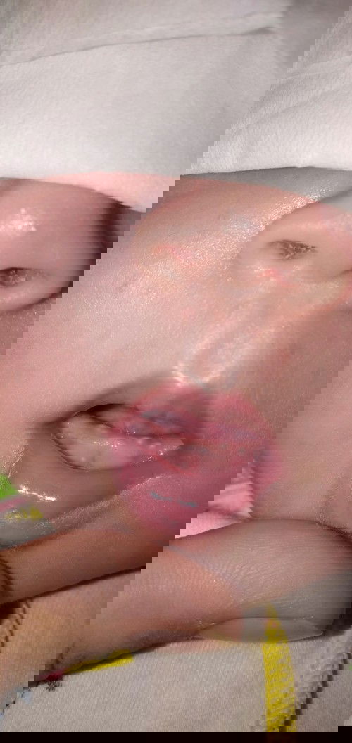 benjolan kecil putih