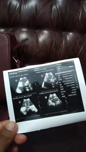 18w4d