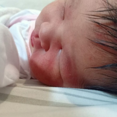 Bakit po kaya ganito skin ni baby. She is 1 day old.