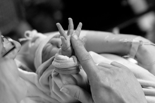 Pendapat anda tentang punca utama kecacatan pada bayi baru lahir?