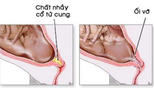 Đâu là những dấu hiệu sắp sinh mẹ thấy rõ rệt trong tuần cuối trước khi sinh?