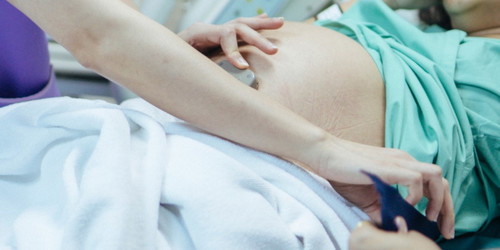 Have/had you tried to induce labour?