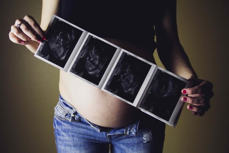 Adakah anda fikir bayi meninggal dalam kandungan masih menjadi masalah pada masa kini?