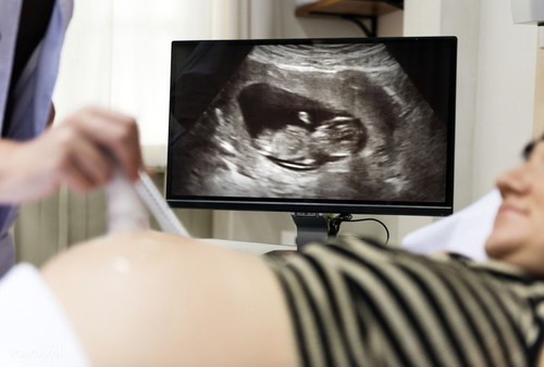 Jantina bayi sama tak sewaktu pemeriksan dan selepas bersalin?