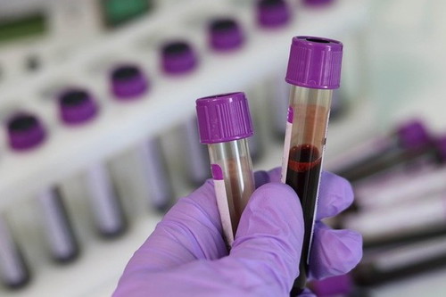 Madalas ka bang magpa-bloodtest?