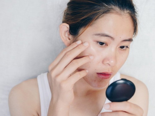 Did your skin condition changed during pregnancy?