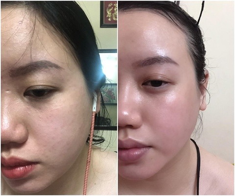 Trong 2 lựa chọn dưới đây, bạn thích cái nào hơn?