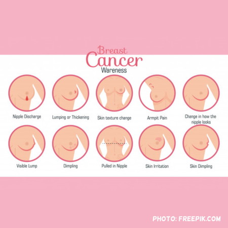 Regular mo bang chine-check ang iyong suso para sa sintomas ng breast cancer?