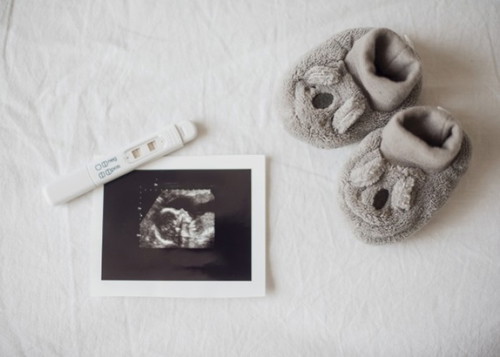 Naitago mo ba ang mga sonogram (ultrasound) print-outs ng pagbubuntis mo?