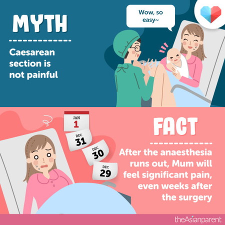 Para sa CS moms: Matagal ba bago kayo naka-recover mula sa operasyon ninyo?