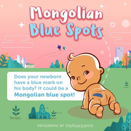 May Mongolian blue spot (blue or green na parang balat) ba si baby sa katawan niya?