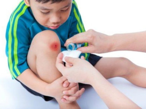 Do you know basic first aid skills?