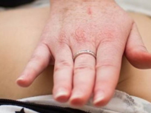 Which type of condition do you deal with often?
Read: <a href='https://sg.theasianparent.com/first-aid-101-part-one' target='_blank' >https://sg.theasianparent.com/first-aid-101-part-one</a>